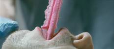 Filmstill Suiker (Sugar)